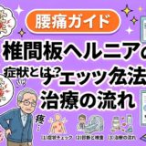 椎間板ヘルニアの症状とは？チェック法と治療の流れのアイキャッチ画像