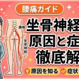 坐骨神経痛の原因と症状を徹底解説|チェック法も紹介のアイキャッチ画像